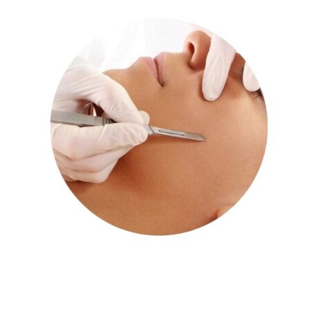 dermaplanning
